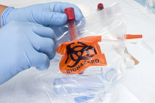 Imballaggio del campione per il trasporto: borse per campioni di biohazard
